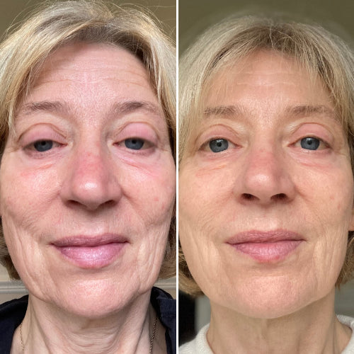 <em>Clara T., 29 – Brisbane, QLD</em>