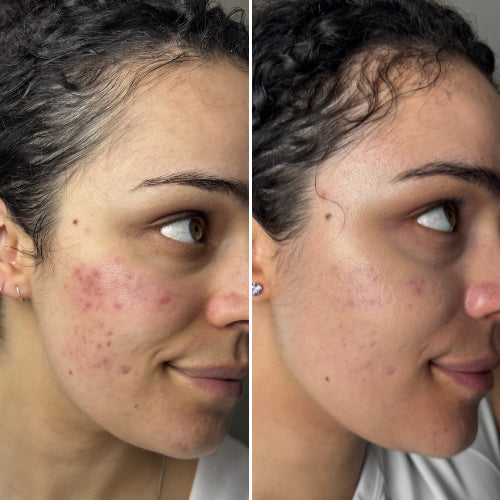 <em>Sophie R., 41 – Melbourne, VIC</em>